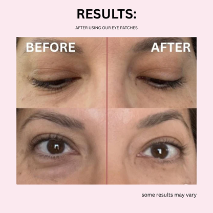 The Peptide Collagen Hydrogel Eye Patch