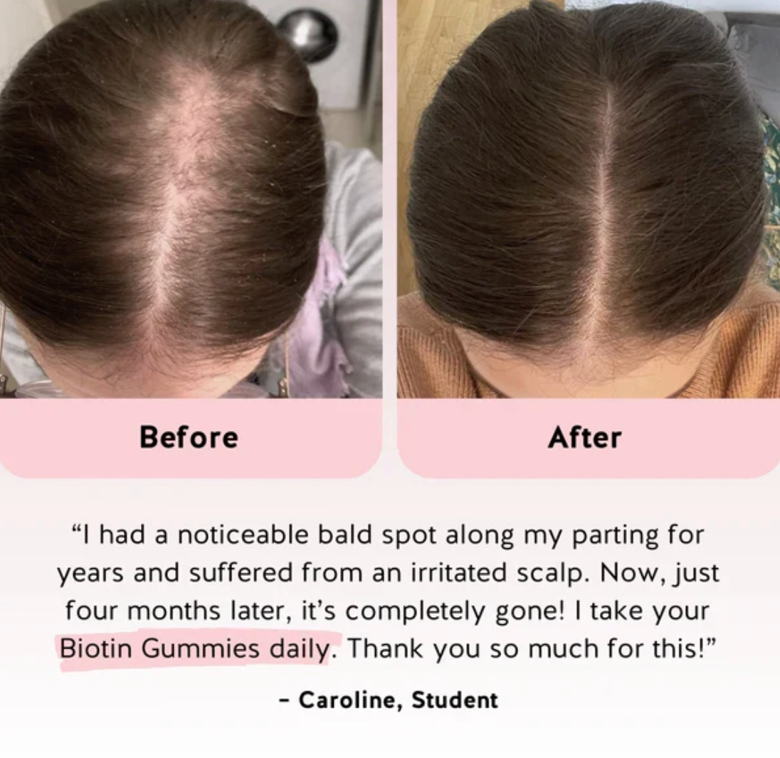 Biotin Hair Gummies