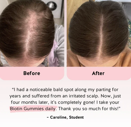 Biotin Hair Gummies